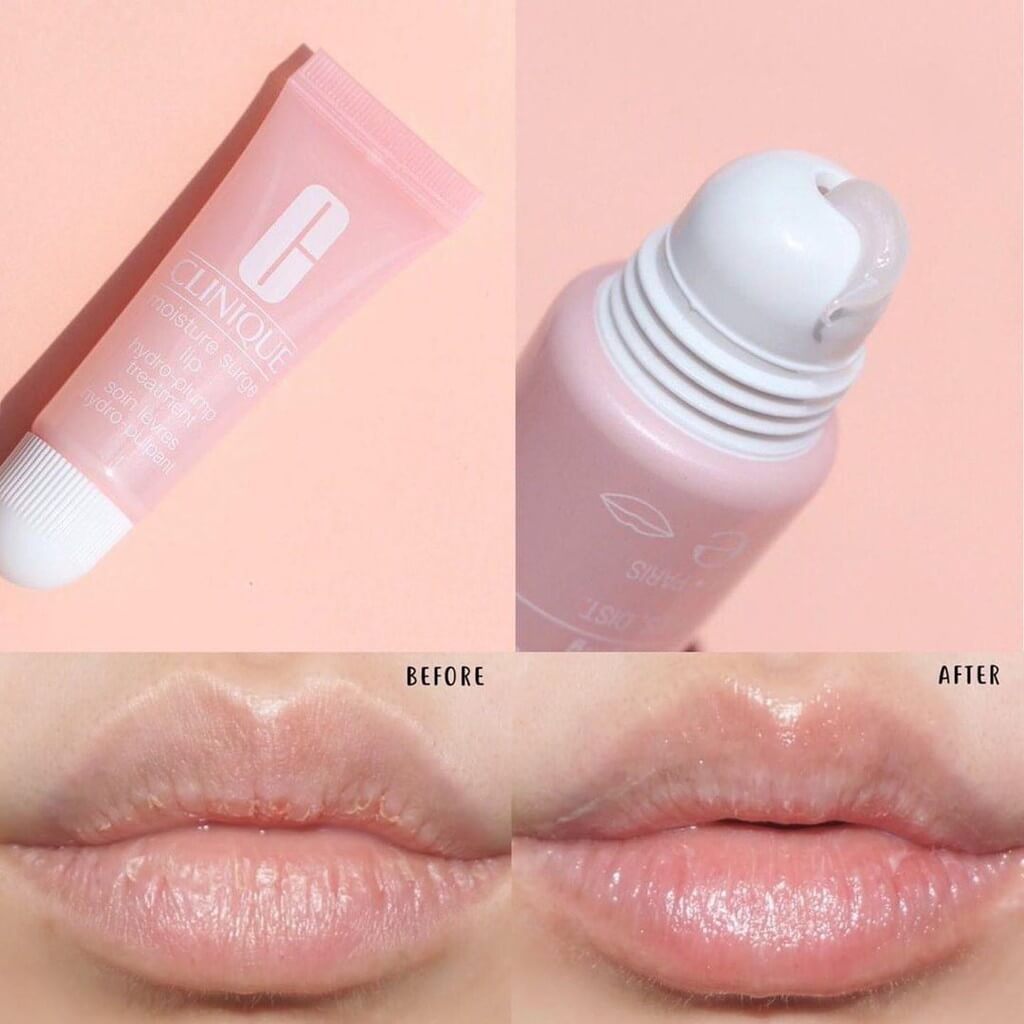 EXPIRY 2026 Clinique Moisture Surge Lip Hydro-Plump Treatment 10ml - For All Skin Types, Lip Balm, Lip Gloss, Lip Treatment, Clinique Lip Balm